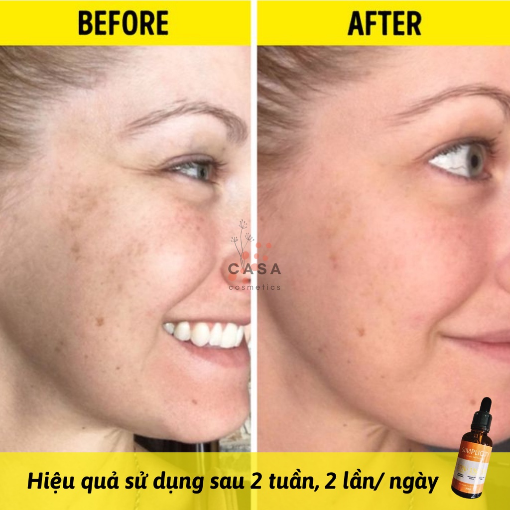 Serum trắng da mờ thâm 20% Vitamin C 0.5% Ferulic acid 1% Vitamin E