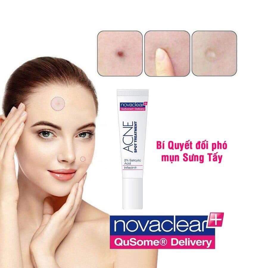 Chấm mụn NOVA CLEAR - Gel chấm mụn chống viêm cho da mụn cao cấp | BigBuy360 - bigbuy360.vn