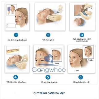 Dịch vụ Căng Da mặt perfect tại Gangwhoo