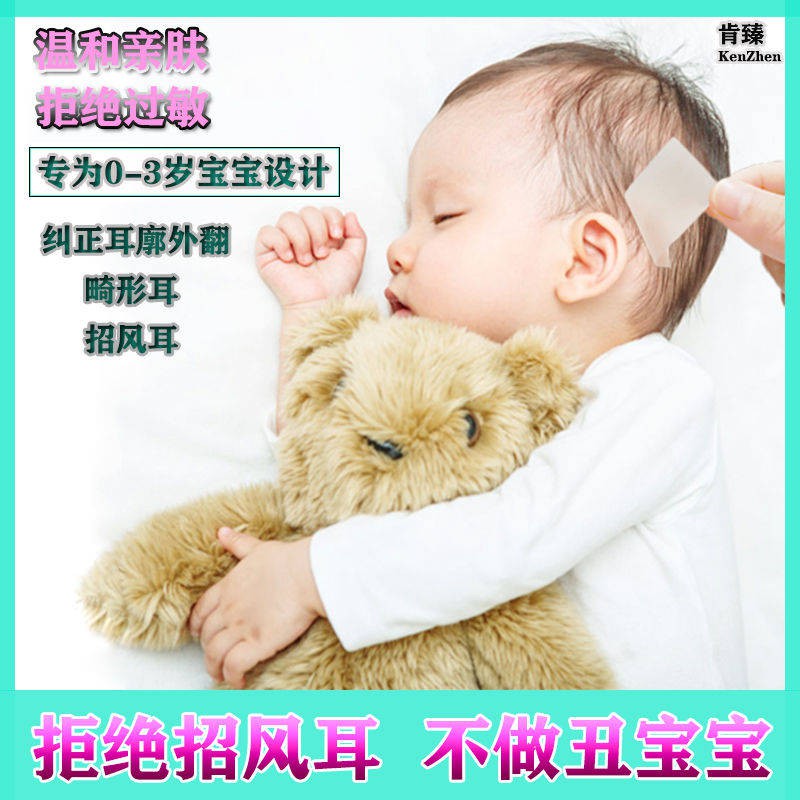 Infant silicone hồ sơ sửa chữa bé chống lừa đảo chính xác tai mới cố định biến dạng thể hiệnnội  địa