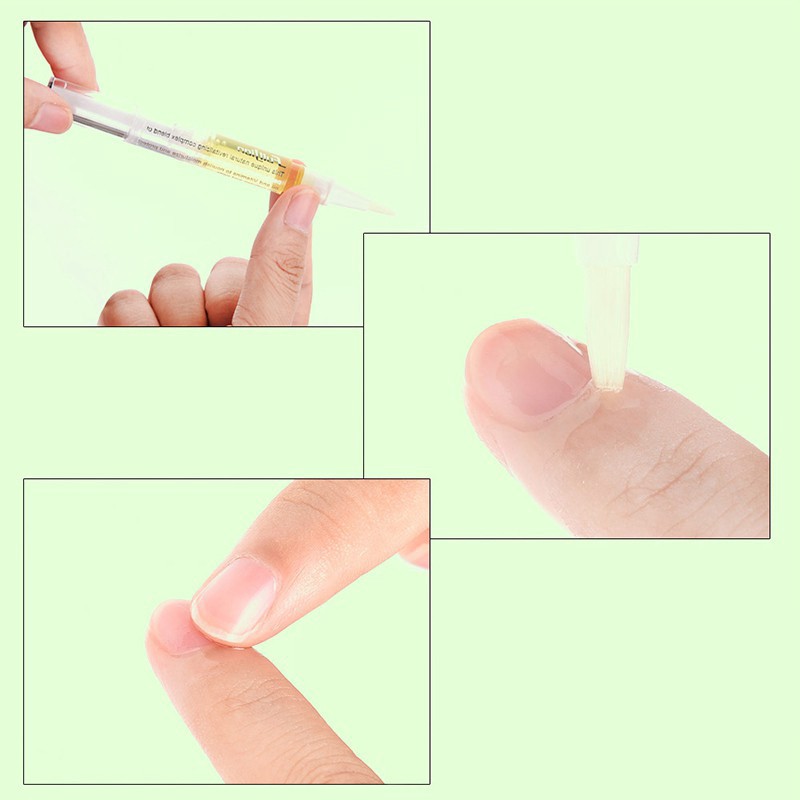 Bút tinh dầu phục hồi làm mềm lớp biểu bì móng tay với nhiều mùi