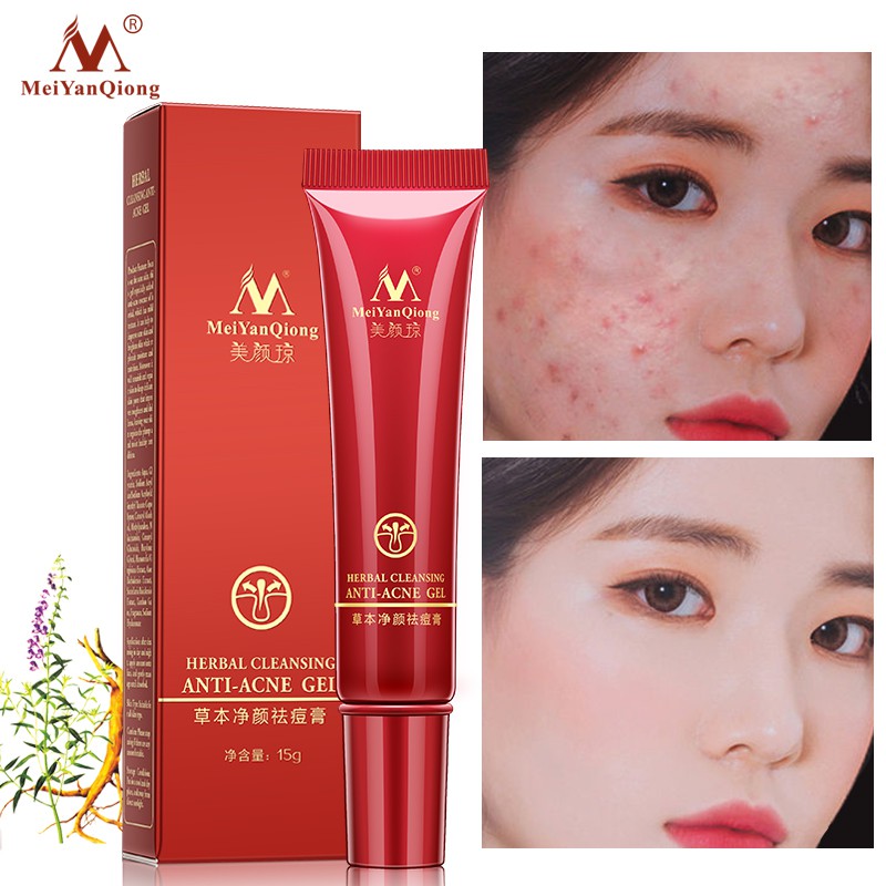 Kem Chăm Sóc Da Mặt MeiYanQiong 15g Làm Sáng Da Cải Thiện Độ Thô Ráp Và Xỉn Màu | BigBuy360 - bigbuy360.vn