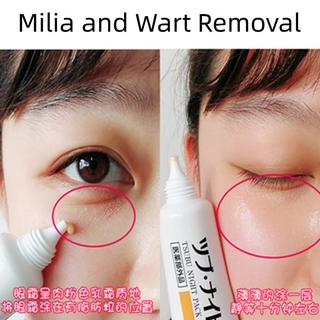 [Hàng mới về] Mặt nạ mắt Tsubu Nhật Bản 30g loại bỏ hạt mỡ phục hồi ban đêm