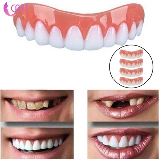 Silicone Instant Smile False Veneers Mỹ phẩm Răng Cover