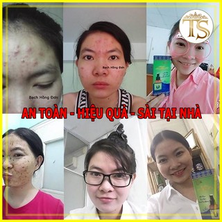 (っ◔◡◔)っ ♥ TINH CHẤT ♥ HẾT MỤN NÁM BHD