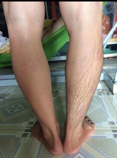Combo Wax mật ong shiny + Mỡ trăn