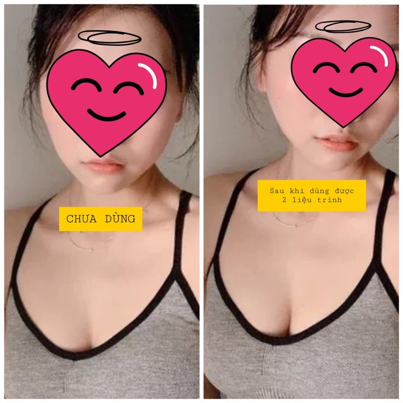 Kem Massage Tăng Vòng 1 Pico