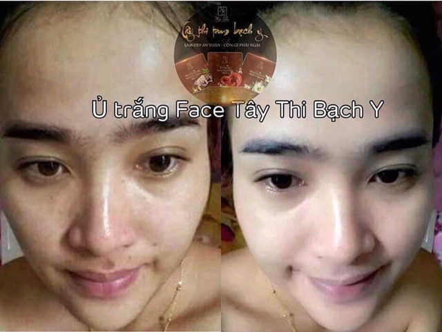 Ủ trắng face tây thi bạch y | BigBuy360 - bigbuy360.vn