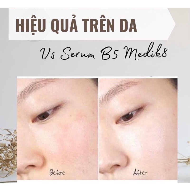 SERUM CẤP ẨM PHỤC HỒI DA B5 MEDIK8
