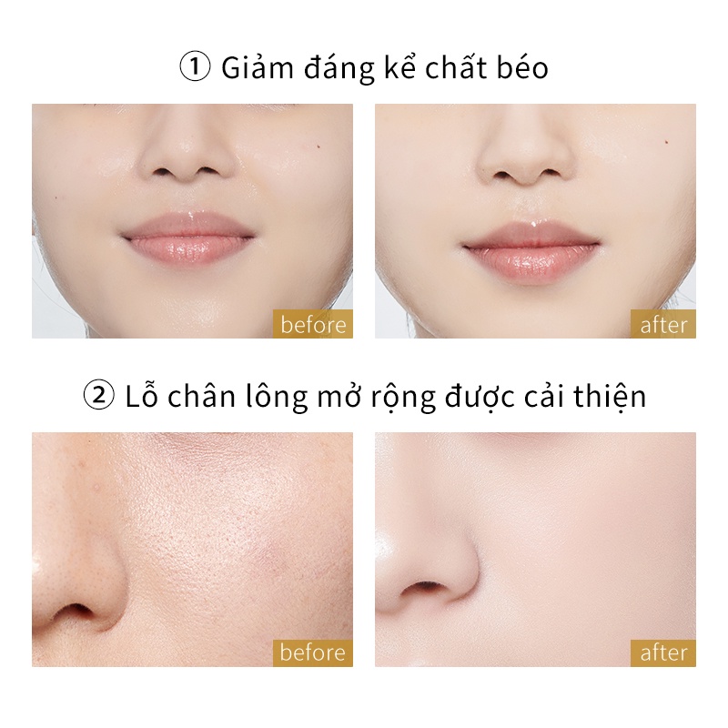 Mặt Nạ Ngủ Honey & Beauty Chiết Xuất Hoa Cúc Vạn Thọ Bổ Sung Nước Dưỡng Ẩm Se Khít Lỗ Chân Lông 100g