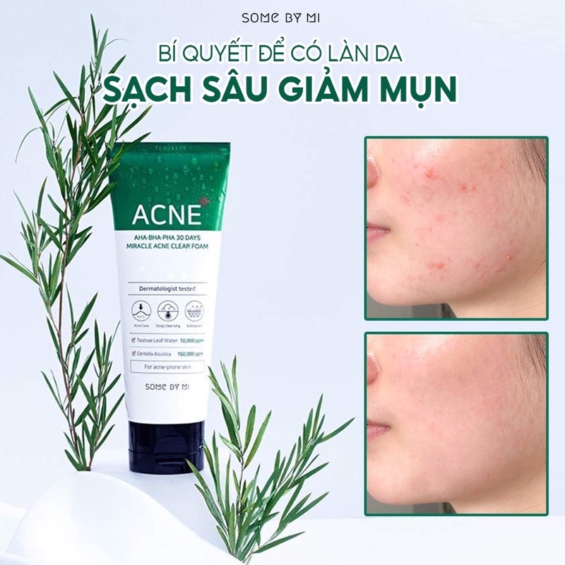 Combo 2 Tuýp Sữa Rửa Mặt Some By Mi AHA-BHA-PHA 30 Days Miracel Acne Clear Foam 100ml