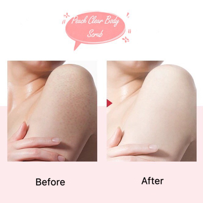 Tẩy Da Chết Tế Bào Chết Tinh Chất Đào Toàn Thân HEYXI Peach Clear Body Scrub Moisturizing Nourishing HEYX05