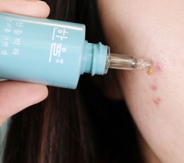 GEL NG.ỪA MỤN HANYUL MENTHA TROUBLE SPOT