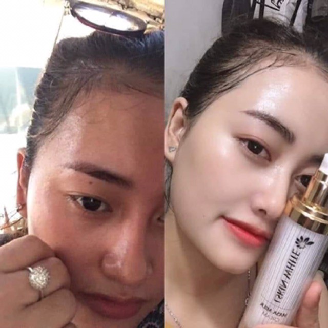 [RẺ VÔ ĐỊCH] Ủ TRẮNG KÉN TẰM CHÍNH HÃNG | BigBuy360 - bigbuy360.vn