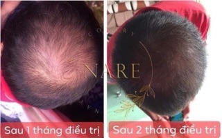 Tinh dầu bưởi Nare
