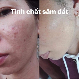 Tinh chất sâm đất