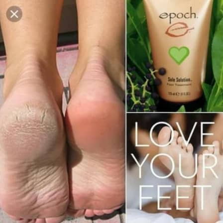 Kem Dưỡng Da Chân- EPOCH SOLE SOLUTION FOOT TREATMENT