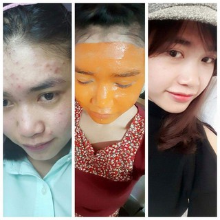 NẠ BẮC THẢO DƯỢC  SWHITE