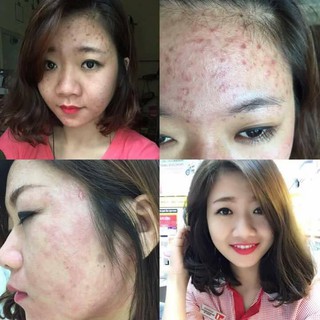 Lăn Ngọc Sâm Mini