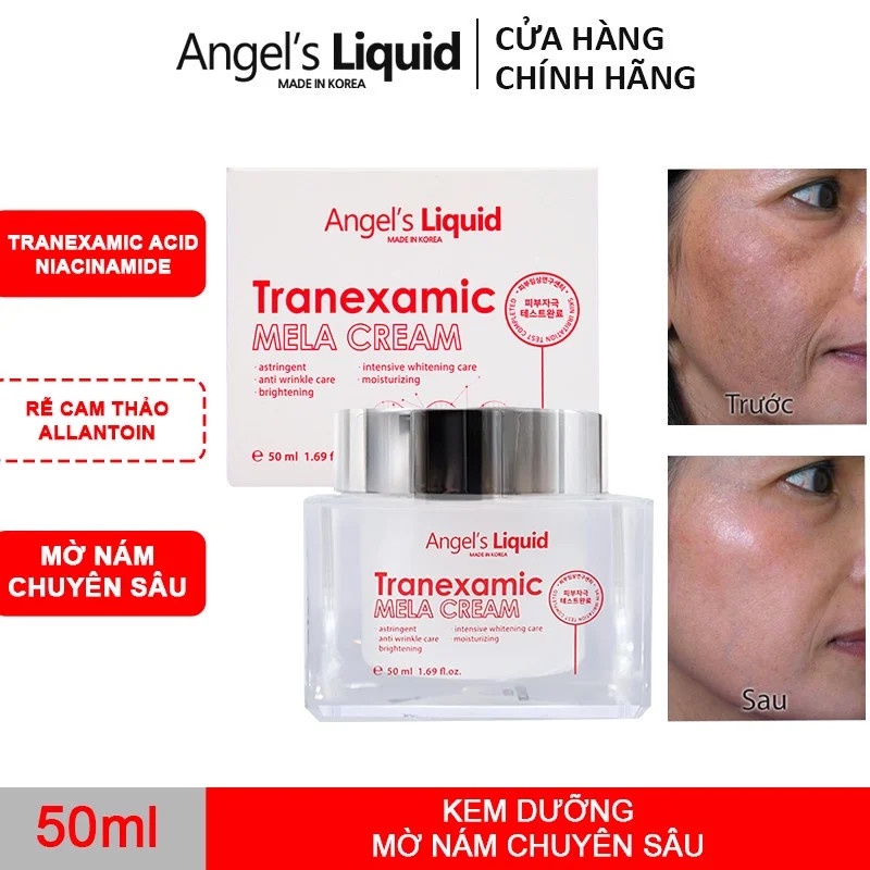 Combo 2 Sản Phẩm Giảm Thăm, Đỏ Mờ Nám Chuyên Sâu Angel's Liquid Tranexamic (Siêu Tinh Chất  30ml + Kem Nám 50ml)