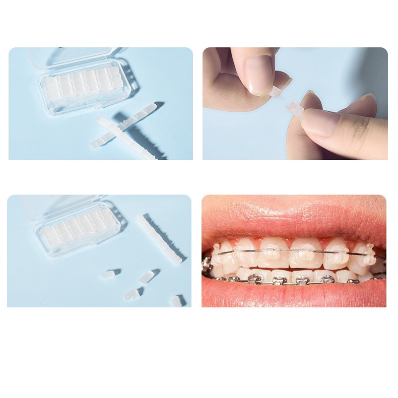 HCM | Sáp nha khoa, sáp niềng răng, dùng giảm đau khi niềng răng, sáp niềng răng nhiều mùi