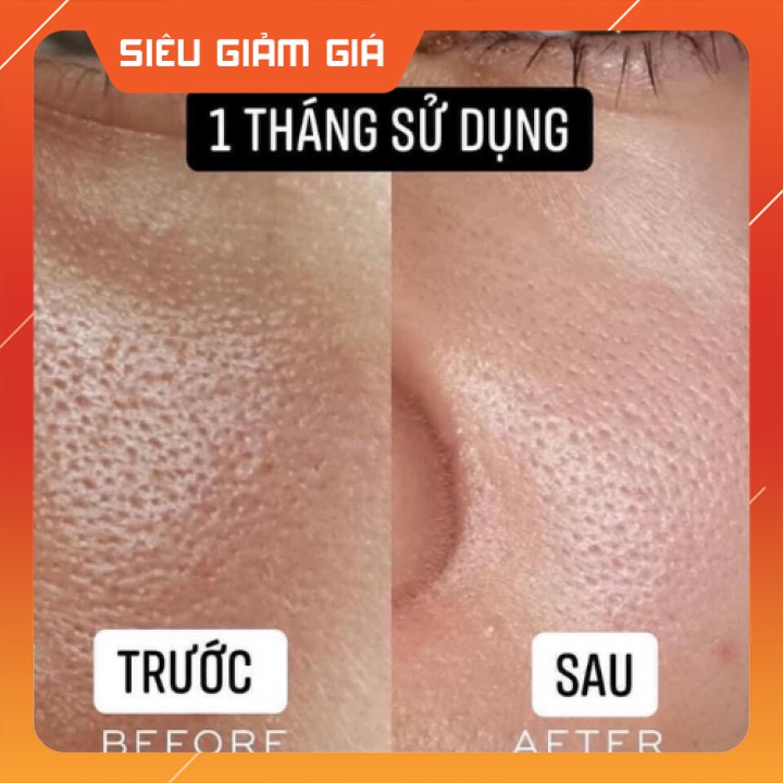 Kem Dưỡng Vita-A Cream Forte(0.01%-0.05%)/ 20ml - Retinal Dr.different [CHÍNH HÃNG] | BigBuy360 - bigbuy360.vn