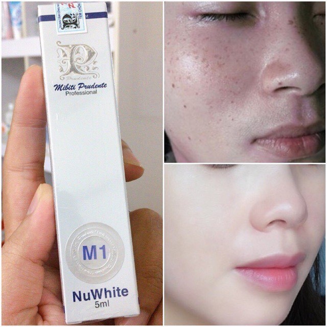 MIBITI PRUDENTE NUWHITE M1 - Kem Làm Mờ Vết #Nám #NuWhite M1