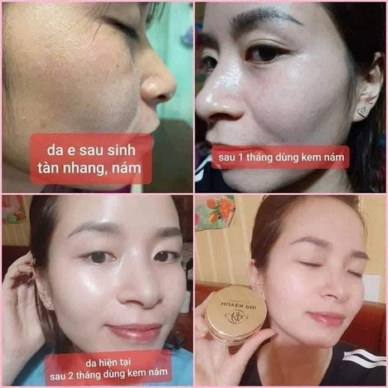 [CHÍNH HÃNG] Kem nám Huyền Phi 30g