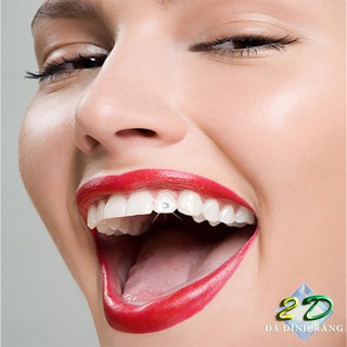 Đá đính răng Thụy Sĩ 2LY (loại nhỏ)