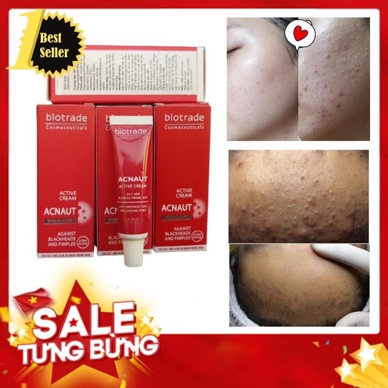 Lotion giảm mụn 10ml/ kem chấm mụn Biotrade Acne Out Active Lotion 5ml