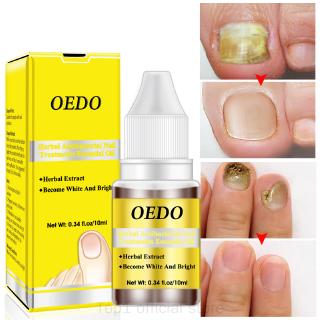 Tinh Dầu Bacidal Tự Nhiên Trị Nấm Móng Chân Dưỡng Ẩm Trị Nấm 10ml Tslm2