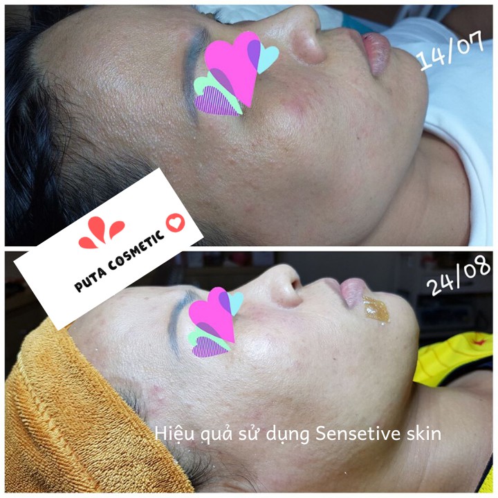 Tinh chất cho da nhạy cảm Toskani Sensitive Skin - Làm dịu, giảm kích ứng, phục hồi da 2ml