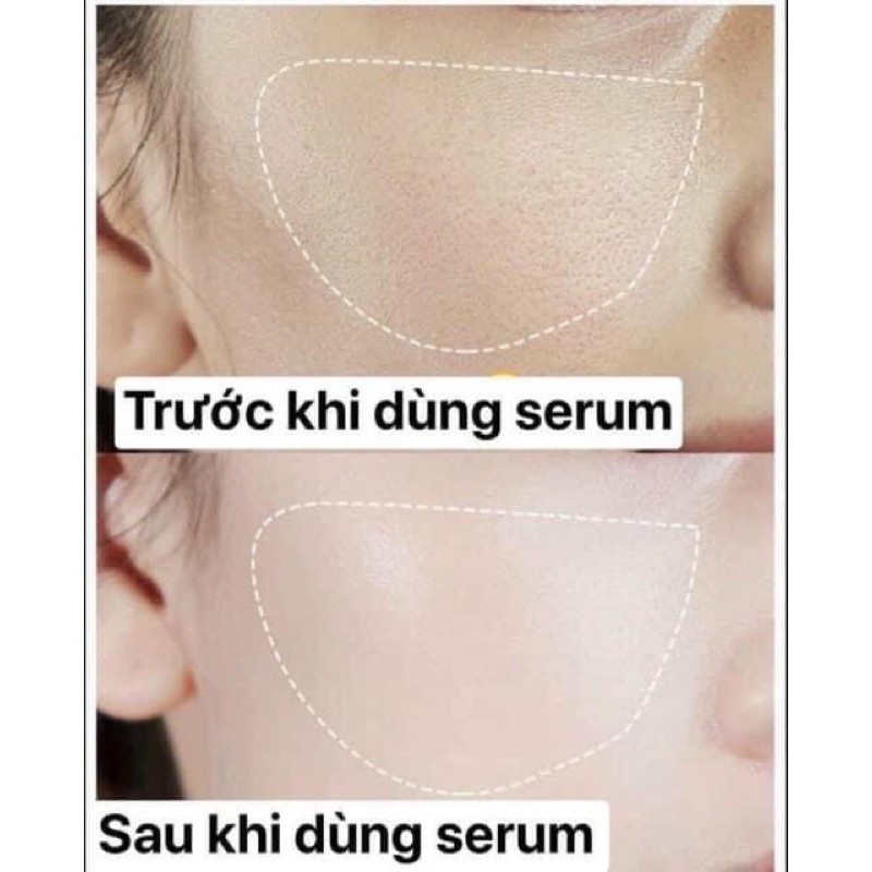 Serum Heyxi tinh chất se khít lỗ chân lông làm dịu da