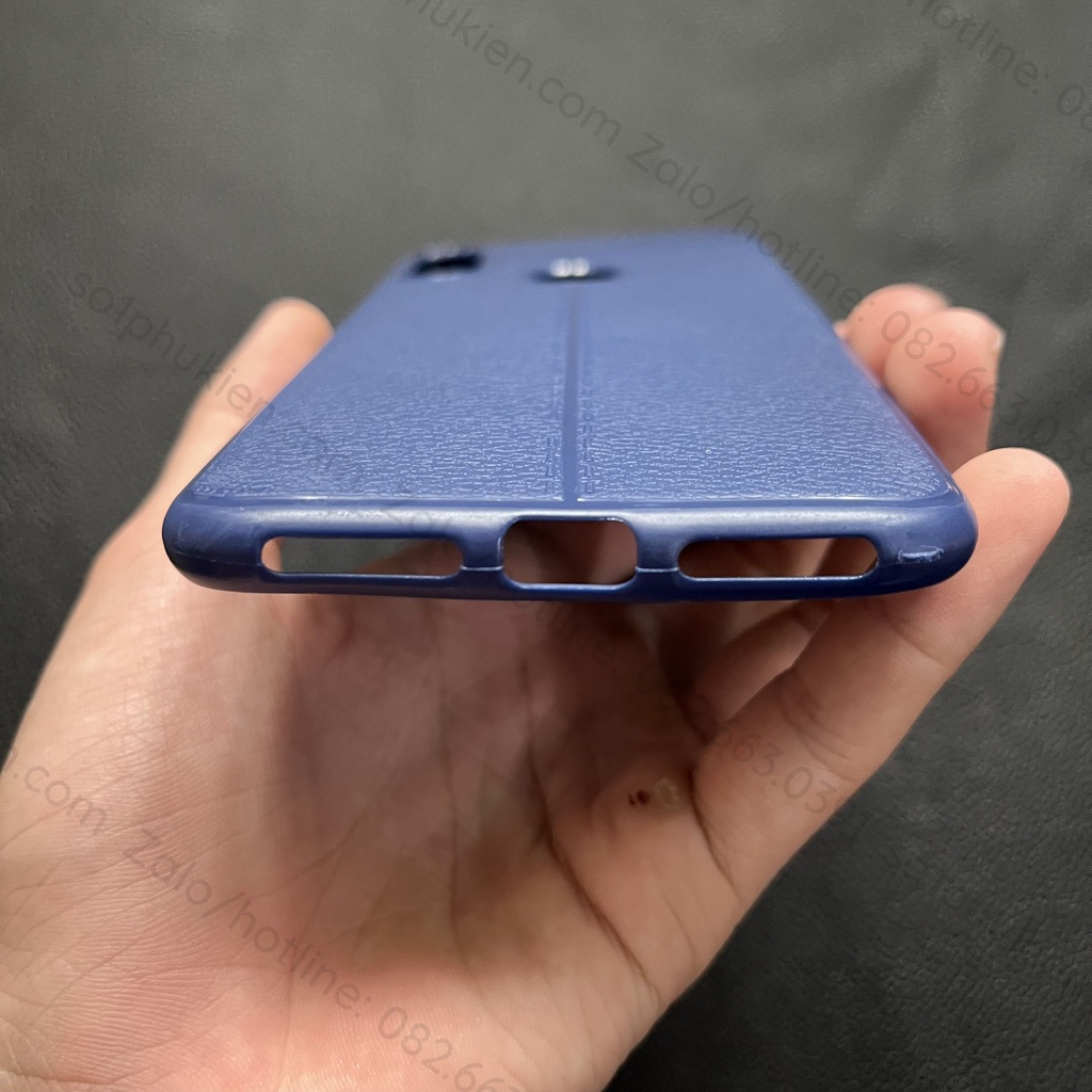 Ốp lưng Xiaomi Mi S2 dẻo vân giả da auto bền đẹp