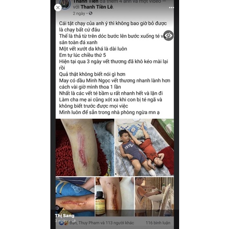 Dầu Minh Ngọc cầm máu, nhanh lành vết thương 30ml- JET Natural Store