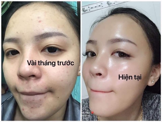 Sữa ong chúa thiên nhiên 2T