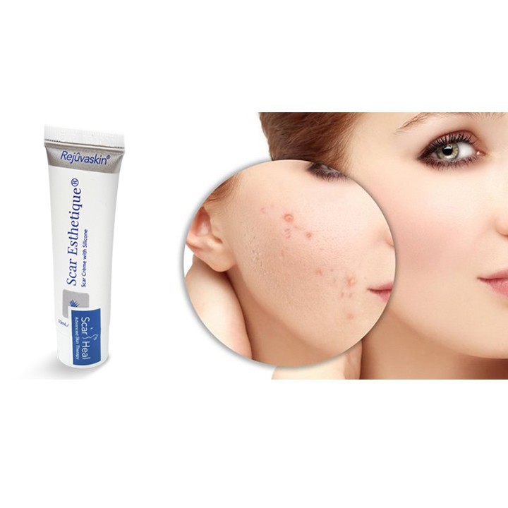 Kem Trị Sẹo Của Mỹ - Scar Esthetique - Phân phối chính thức | BigBuy360 - bigbuy360.vn