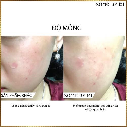  Miếng dán mụn Some By Mi Acnes Clear Patch gói 18 miếng SAC8 | BigBuy360 - bigbuy360.vn
