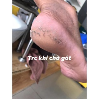 Dụng cụ chà/mài gót chân 4 in 1