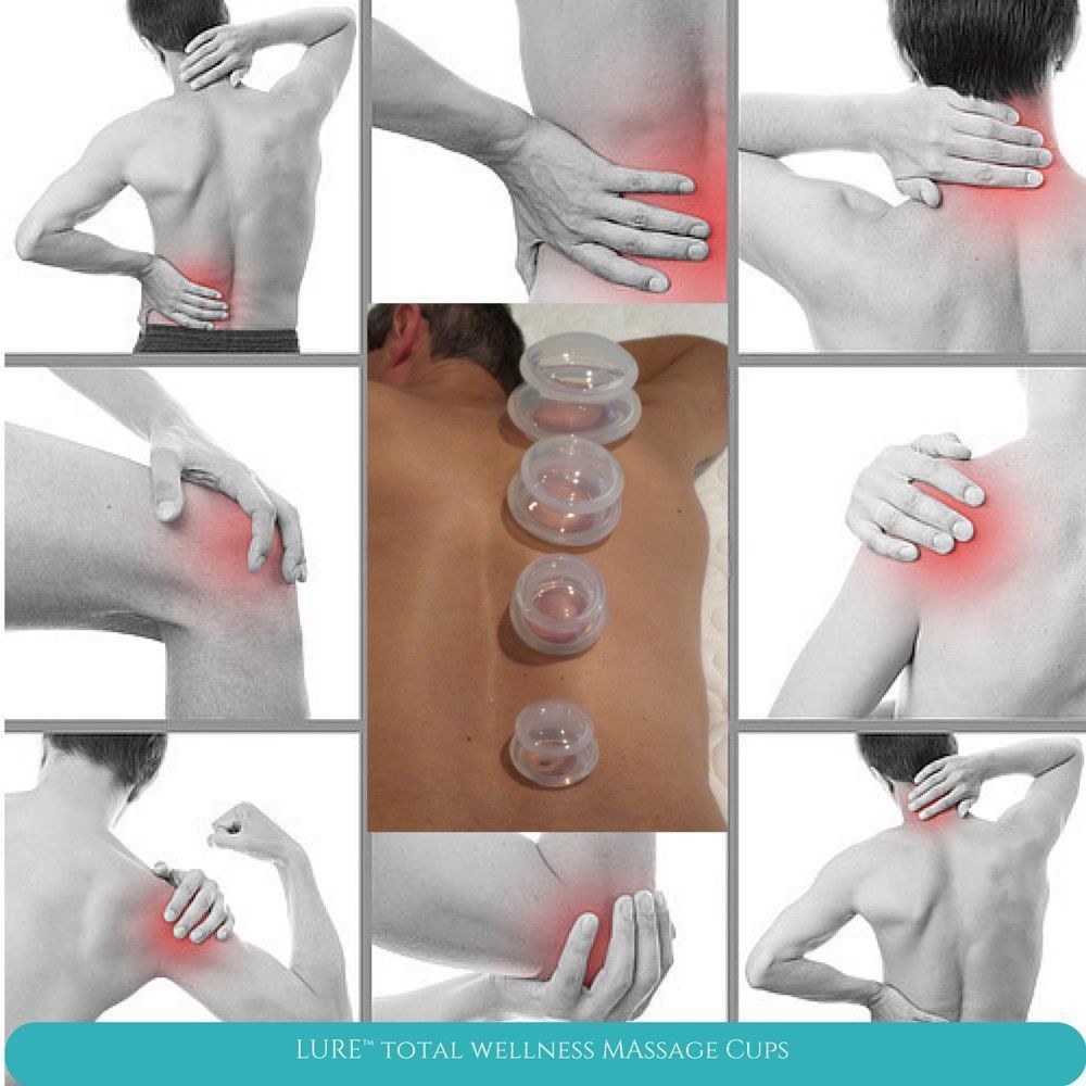 [Hàng mới về] Set dụng cụ giác hơi bằng silicon