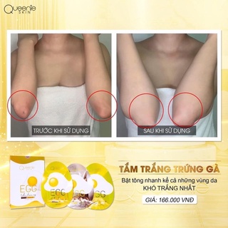 TẮM TRẮNG TRỨNG GÀ