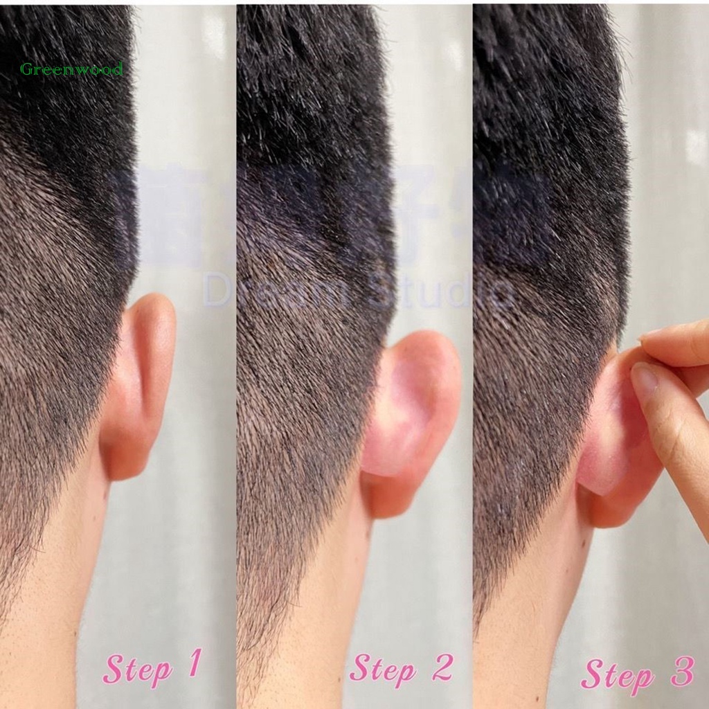 Miếng dán chỉnh sửa dáng tai không gây kích ứng lâu trôi dành cho nữ