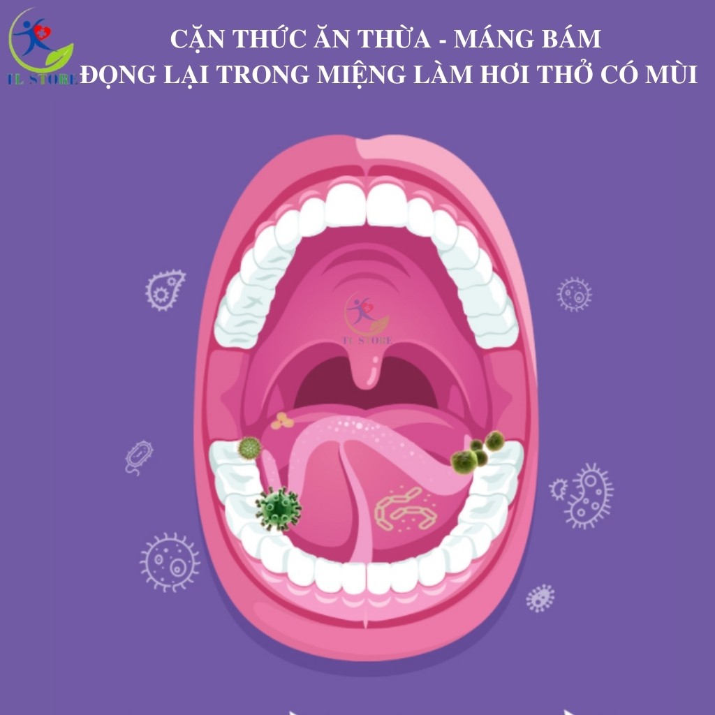 Lọ xịt thơm miệng Baimiss 10ml