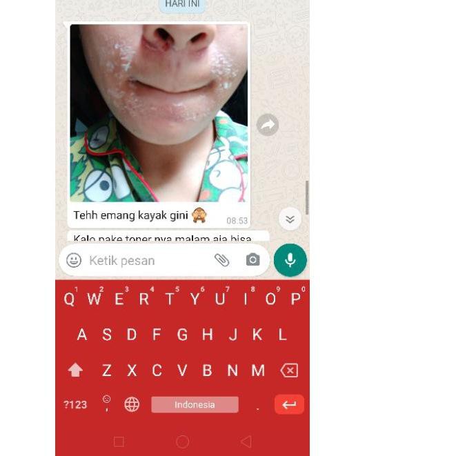 (hàng Mới Về) Kem Nirmala Dưỡng Trắng Chăm Sóc Da Mặt | BigBuy360 - bigbuy360.vn