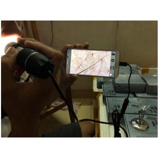 Máy Soi Da, Soi Tóc Kết Nối Máy tính