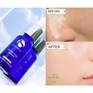 Serum Is Clinical Hydra - Cool B5 dưỡng ẩm làm dịu da