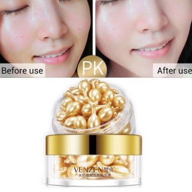 Hộp 30 Viên Tinh Chất Dưỡng Da Venzen