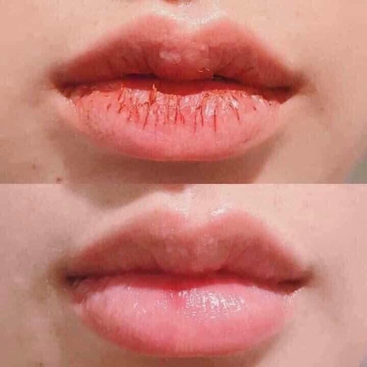 Tẩy tế bào chết môi Beauty Treats Lip Scrub 10.5g