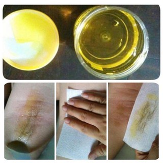 Wax lông lạnh mật ong Horshion