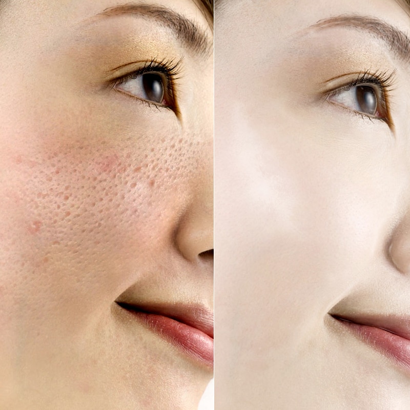[Hàng mới về] Serum Vibrant Glamor axit hyaluronic 15ml dưỡng ẩm chống lão hóa se khít lỗ chân lông